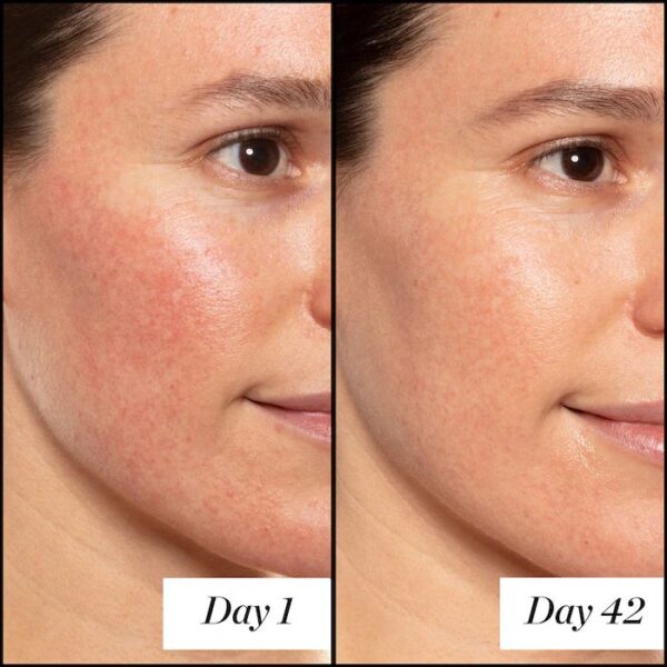 Sunday Riley  A+ High-Dose Retinol Serum - Image 2